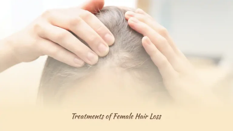 Treatments of Female Hair Loss